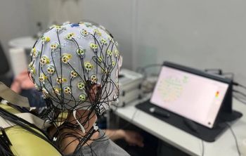 Ученые впервые смоделировали состояние мозга во время эпилептического припадка