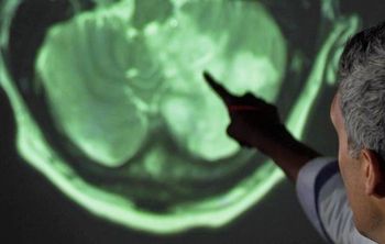 Открытие уральских ученых поможет победить рак мозга