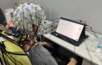 Мозг подключает лобные доли для восприятия сложных объектов — выяснили калининградские учёные 