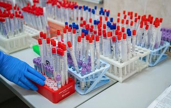 Ученые России, Турции и Молдавии разрабатывают новые методики лечения рассеянного склероза и псориаза