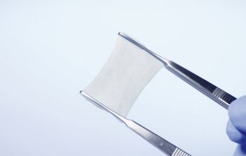 Российские учёные разработали способ производства стоматологических мембран без дефектов