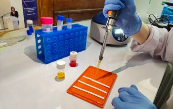 Саратовские ученые разработали экспресс-тест для определения сердечной недостаточности