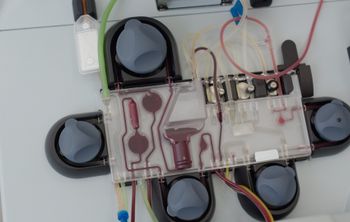 Онкологию будут лечить с помощью клеток-киллеров