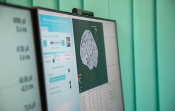 Учёные выявили новые аномалии в работе мозга у девочек с синдромом Ретта