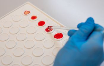 Самарские ученые разработали тест-систему для быстрой диагностики сепсиса