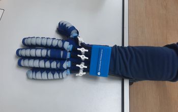 В Сеченовском Университете разработали перчатку для восстановления после инсульта