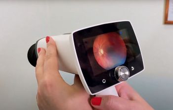 Разработка томских ученых «Офтальмик+» помогла сохранить зрение сотням пациентов