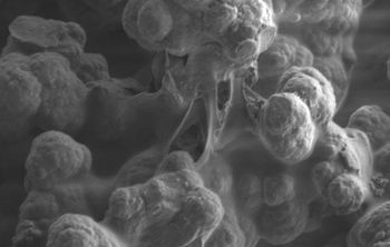 Ученые разработали новый материал, имитирующий свойства кости