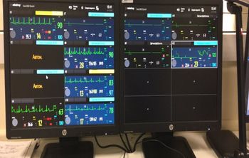 Создана единая экосистема для анестезиологии и реанимации