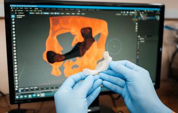 Томские ученые разработали импортозамещающие импланты для пациентов с онкологией