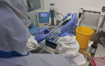 Ученые из Санкт-Петербурга нашли эффективный способ контроля за развитием заболевания COVID-19