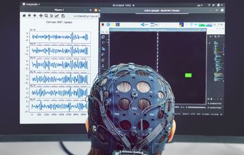 Ученые ННГУ создали первую в России систему нейроуправления медицинскими протезами  на мемристорах