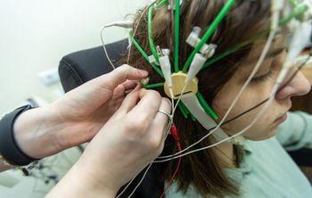 В России создали самообучающуюся программу для диагностики эпилепсии